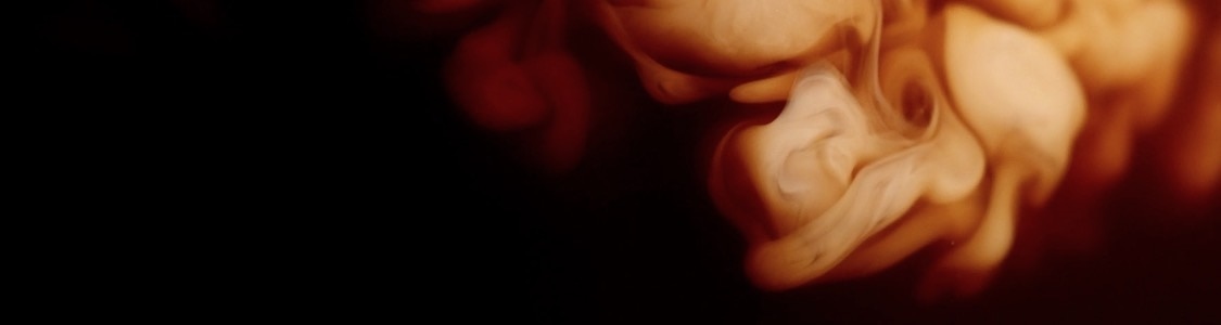 VÝHODNÁ BALENIA banner